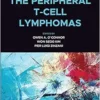 The Peripheral T-Cell Lymphomas (EPUB)