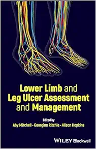 Lower Limb And Leg Ulcer Assessment And Management (PDF Book)
