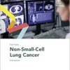 Fast Facts: Non-Small-Cell Lung Cancer, 2nd Edition (PDF)