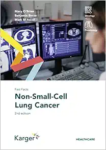Fast Facts: Non-Small-Cell Lung Cancer, 2nd Edition (PDF Book)