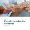 Fast Facts: Chronic Lymphocytic Leukemia, 2nd Edition (PDF)