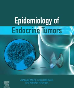 Epidemiology Of Endocrine Tumors (EPUB)
