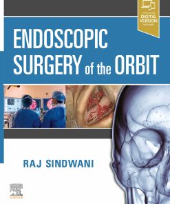 Endoscopic Surgery Of The Orbit (EPUB)