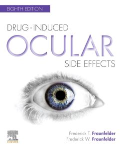Drug-Induced Ocular Side Effects:Clinical Ocular Toxicology, 8th Edition (EPUB)