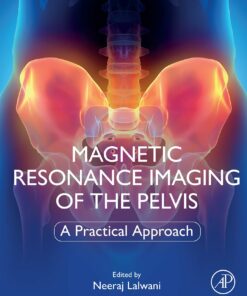 Magnetic Resonance Imaging Of The Pelvis: A Practical Approach (EPUB)