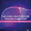 The Liver Graft Before Transplantation: Defining Outcome After Liver Transplantation (PDF)