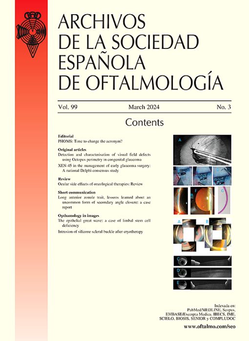 Archivos de la Sociedad Española de Oftalmología (English Edition): Volume 99 (Issue 1 to Issue 3) 2024 PDF