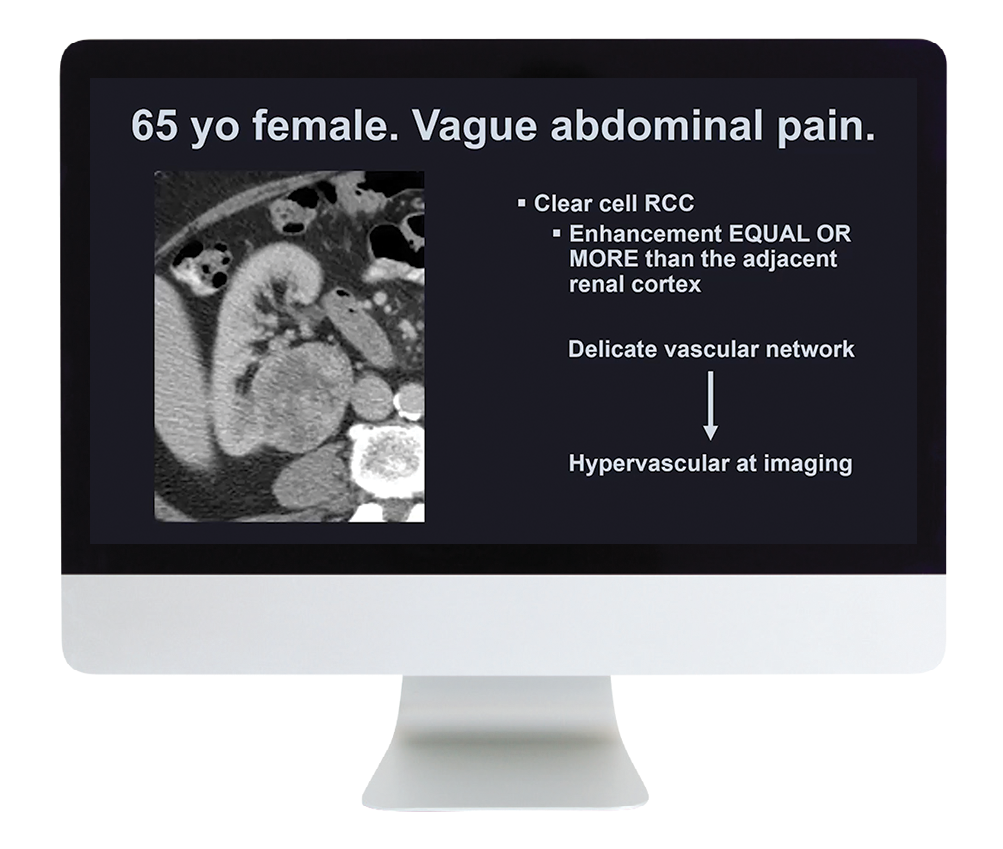 Case Review of Abdominal Imaging