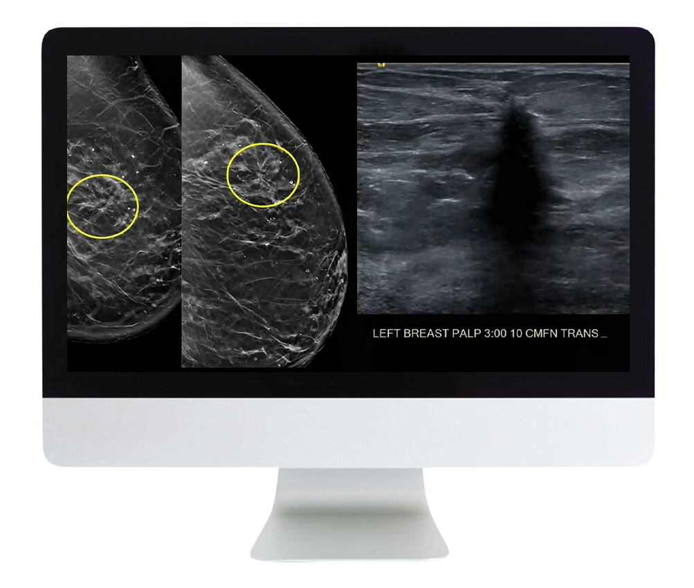 Case Review of Breast Imaging