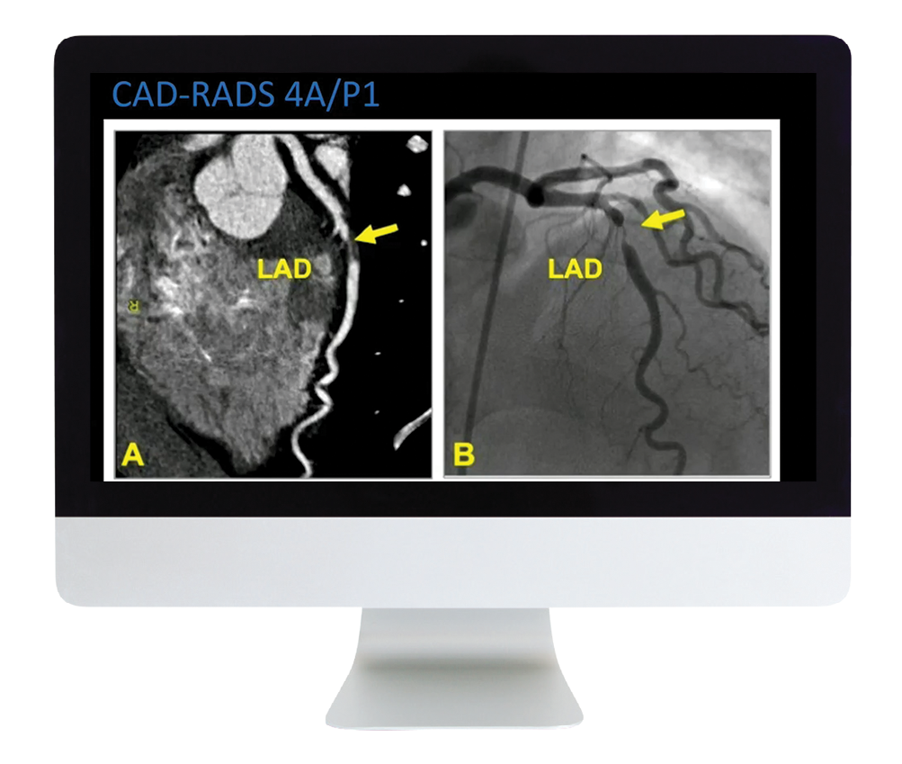 Case Review of Cardiopulmonary Imaging