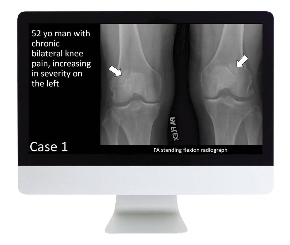 Case Review of Musculoskeletal Imaging