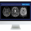Case Review of Neuroradiology