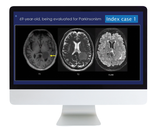 Case Review of Neuroradiology