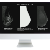 Contrast Enhanced Mammography: The Essentials and Beyond