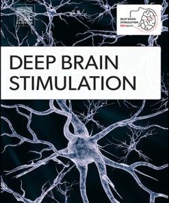 Deep Brain Stimulation: Volume 1 to Volume 3 2023 PDF