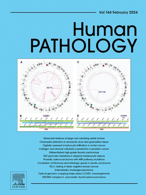 Human Pathology: Volume 143 to Volume 144 2024 PDF
