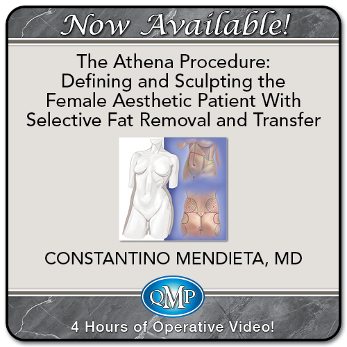 The Athena Procedure: Defining and Sculpting the Female Aesthetic Patient With Selective Fat Removal and Transfer 2024