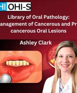 OHI-S – Library of Oral Pathology: Management of Cancerous and Precancerous Oral Lesions