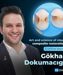 OHI-S Art and Science of Class 2 Composite Restorations