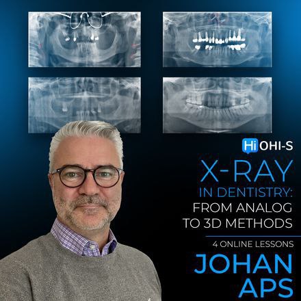 OHI-S X-ray in Dentistry: From Analog to 3D Methods