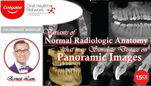 Variants of Normal Radiologic Anatomy that may Simulate Disease on Panoramic Images – Ernest Lam