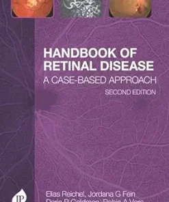 Handbook Of Retinal Disease: A Case- Based Approach, 2ed (PDF)
