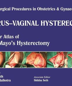 Single Surgical Procedures in Obstetrics and Gynaecology-12: Uterus-Vaginal Hysterectomy – A Color Atlas of Ward Mayo’s Vaginal Hysterectomy (POD) (PDF)
