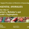 Single Surgical Procedures in Obstetrics and Gynaecology: Volume 32: Congenital Anomalies: A Colour Atlas of Wharton’s, McIndoe’s and Nagrath’s … Procedures in Obstetrics & Gynaecology) 32nd ed. Edition (PDF)