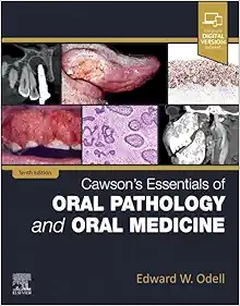 Cawson’s Essentials Of Oral Pathology And Oral Medicine, 10th Edition (True PDF)