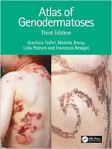 Atlas Of Genodermatoses 3e (PDF)