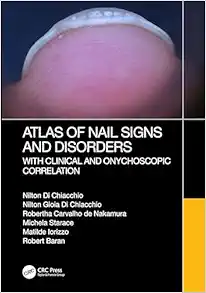 Atlas Of Nail Signs And Disorders With Clinical And Onychoscopic Correlation (PDF)
