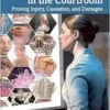 Medical Illustration In The Courtroom: Proving Injury, Causation, And Damages (PDF)