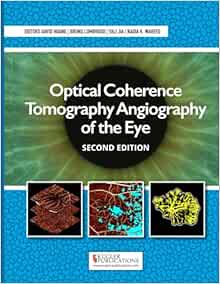 Optical Coherence Tomography Angiography Of The Eye, 2nd Edition (Converted PDF)