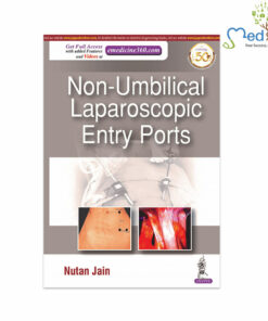 Non-Umbilical Laparoscopic Entry Ports