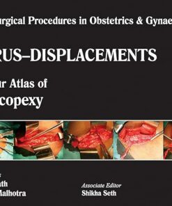 Single Surgical Procedures in Obstetrics and Gynaecology 15: A Colour Atlas of Cervicopexy (Purandare s): Single Surgical Procedures In Obs &Gyne 1st Edition (PDF)