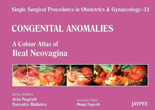 Single Surgical Procedures in Obstetrics and Gynaecology–33: Vaginoplasty – A Colour Atlas of Ileal Neovagina: A Colour Atlas Of Iieal Neovagina,Congenital Anomalies (PDF)