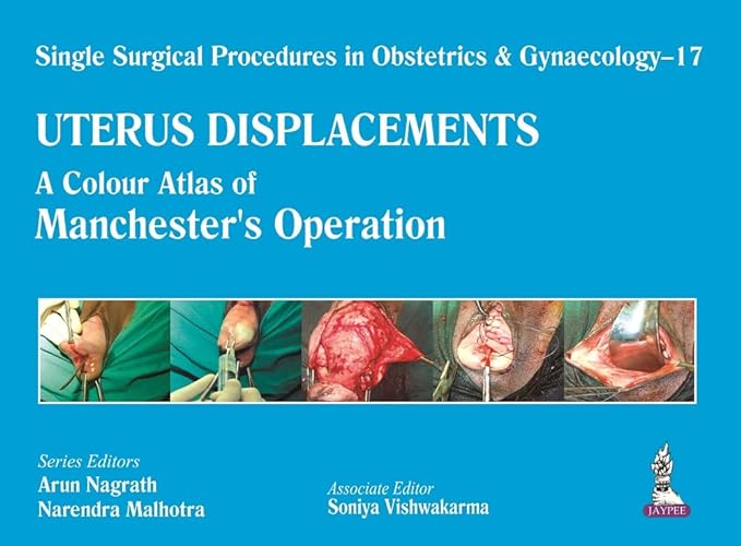 Uterus Displacements: A Colour Atlas of Manchester’s Operation (Single Surgical Procedures in Obstetrics and Gynaecology) 1st Edition (PDF)