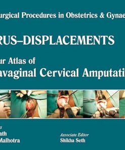 Single Surgical Procedures in Obstetrics and Gynaecology 16: A Colour Atlas of Supravaginal Cervical Amputation (Nadkarni’s): Single Surg.Proced In Obs&Gyne (PDF)