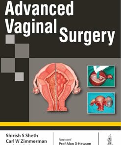 Advanced Vaginal Surgery 1st Edition (PDF)