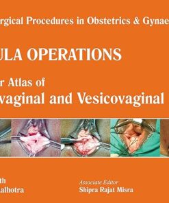 Single Surgical Procedures in Obstetrics and Gynaecology–34: Fistula Operations-A Colour Atlas of Rectovaginal and Vesicovaginal Fistula: A Colour Atlas … & Vesicovaginal Fistula,Fistula Operations 1st Edition (PDF)