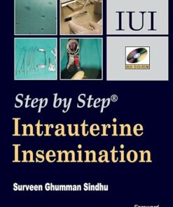 Intrauterine Insemination (Step by Step) (PDF)
