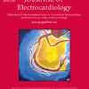 Journal of Electrocardiology: Volume 82 to Volume 83 2024 PDF