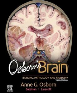 Osborn’s Brain, Imaging, Pathology and Anatomy (3rd Edition) 2024 (PDF)