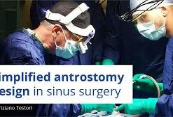 Simplified antrostomy design in sinus surgery (Course)