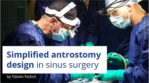 Simplified antrostomy design in sinus surgery (Course)