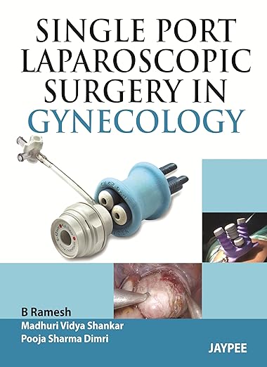 Single-Port Laparoscopic Surgery in Gynecology 1st Edition (PDF)