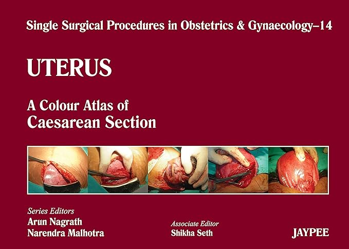 Single Surgical Procedures in Obstetrics and Gynaecology 14: A Colour Atlas of Caesarean Section: A.C.A. of Caesarean Section (Single Surgical Procedures In Obs & Gyne) 1st Edition (PDF)