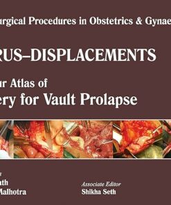 Single Surgical Procedures in Obstetrics and Gynaecology 20: A Colour Atlas of Surgery for Vault Prolapse: A.C.A.of Surgery for Vault Prolapse (Sspo&G) 1st Edition (PDF)
