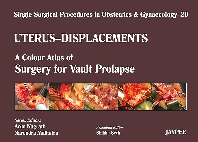 Single Surgical Procedures in Obstetrics and Gynaecology 20: A Colour Atlas of Surgery for Vault Prolapse: A.C.A.of Surgery for Vault Prolapse (Sspo&G) 1st Edition (PDF)