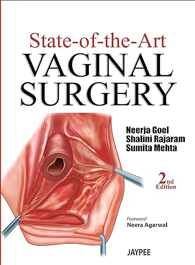 State-of-the-Art: Vaginal Surgery 2nd Edition (PDF)